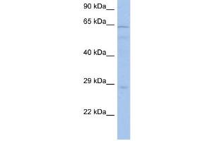 PRKAA1 antibody used at 1 ug/ml to detect target protein. (PRKAA1 Antikörper  (Middle Region))