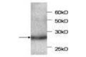 Image no. 1 for anti-serpin Peptidase Inhibitor, Clade B (Ovalbumin), Member 4 (SERPINB4) antibody (ABIN791516) (SERPINB4 Antikörper)