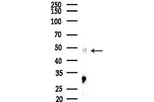 anti-Integrin-Linked Kinase-Associated Serine/threonine Phosphatase 2C (ILKAP) (N-Term) antibody