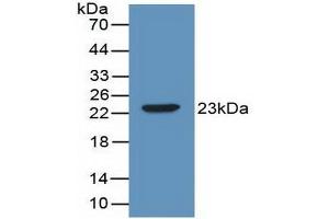 Detection of Recombinant IL2, Mouse using Polyclonal Antibody to Interleukin 2 (IL2) (IL-2 Antikörper  (AA 10-169))