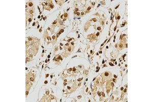 Immunohistochemistry of paraffin-embedded human stomach using NFATC1 antibody at dilution of 1:200 (x400 lens). (NFATC1 Antikörper)