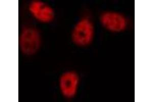 ABIN6274351 staining HepG2 cells by IF/ICC. (GIT2 Antikörper  (Internal Region))
