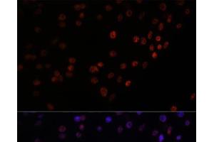 Immunofluorescence analysis of C6 cells using MATR3 Polyclonal Antibody at dilution of 1:100.
