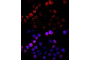 Immunofluorescence analysis of HeLa cells using Aromatase (CYP19) antibody (2684) at dilution of 1:100 (40x lens).