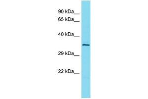 Host: Rabbit Target Name: L3HYPDH Sample Type: OVCAR-3 Whole Cell lysates Antibody Dilution: 1. (L3HYPDH Antikörper  (C-Term))
