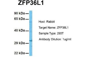 Host: Rabbit Target Name: ZFP36L1 Sample Tissue: Human 293T Antibody Dilution: 1. (ZFP36L1 Antikörper  (N-Term))