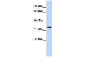 ANP32B antibody used at 1 ug/ml to detect target protein. (ANP32B Antikörper)