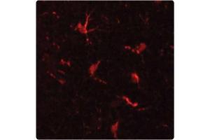 Staining of microglial cells in Mouse cerebral cortex (red) using MAC-1 Antibody . (CD11b Antikörper)