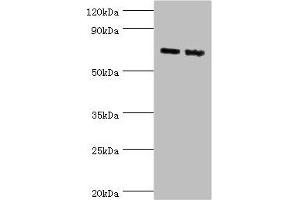 Western blot All lanes: Amyloid-like protein 1 antibody at 6 μg/mL Lane 1: Mouse brain tissue Lane 2: A549 whole cell lysate Secondary Goat polyclonal to rabbit IgG at 1/10000 dilution Predicted band size: 72 kDa Observed band size: 72 kDa (APLP1 Antikörper  (AA 39-300))