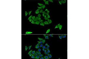 Immunofluorescence analysis of U2OS cells using TGM3 Polyclonal Antibody (TGM3 Antikörper)