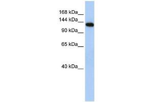 WB Suggested Anti-MYBPC2 Antibody Titration:  0. (MYBPC2 Antikörper  (N-Term))