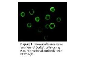 Image no. 3 for anti-Bruton Agammaglobulinemia tyrosine Kinase (BTK) antibody (ABIN232137) (BTK Antikörper)