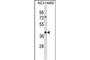 Western blot analysis in NCI-H460 cell line lysates (35ug/lane). (UCHL5 Antikörper  (AA 136-164))