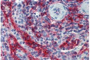 Spleen, Human: Formalin-Fixed, Paraffin-Embedded (FFPE) (HLA-E Antikörper)