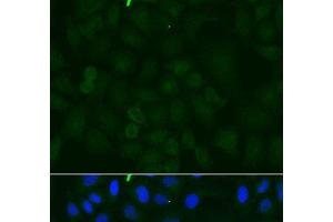 Immunofluorescence analysis of U2OS cells using ATP1A1 Polyclonal Antibody at dilution of 1:100. (ATP1A1 Antikörper)