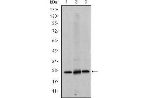 Western blot analysis using EIF4E mouse mAb against Hela (1), HEK293 (2) and K562 (3) cell lysate. (EIF4E Antikörper)