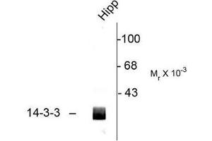 Image no. 1 for anti-14-3-3 alpha + beta (YWHAB) (C-Term) antibody (ABIN372584) (YWHAB Antikörper  (C-Term))