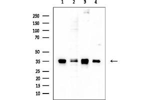 anti-Nanog Homeobox Pseudogene 8 (NANOGP8) (Internal Region) antibody