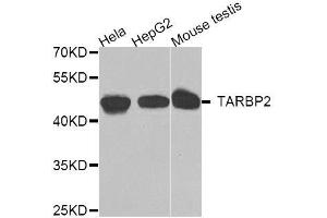Western blot analysis of extracts of various cell lines, using TARBP2 antibody. (TARBP2 Antikörper  (AA 1-366))