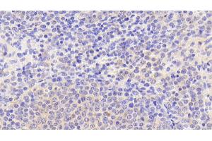 Immunohistochemistry (IHC) image for anti-Peptidyl Arginine Deiminase, Type I (PADI1) (AA 298-556) antibody (ABIN7444877)