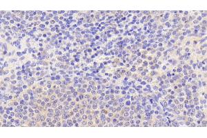 Detection of PADI1 in Human Spleen Tissue using Polyclonal Antibody to Peptidyl Arginine Deiminase Type I (PADI1) (PADI1 Antikörper  (AA 298-556))