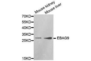 Western blot analysis of extracts of various cell lines, using EBAG9 antibody. (RCAS1 Antikörper  (AA 28-213))