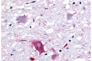 Immunohistochemistry (Formalin/PFA-fixed paraffin-embedded sections) of human brain, neurons and glia with GPR32 polyclonal antibody . (GPR32 Antikörper  (3rd Extracellular Domain))
