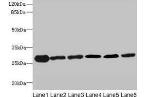 Western blot All lanes: TMED9 antibody at 4. (TMED9 Antikörper  (AA 40-197))
