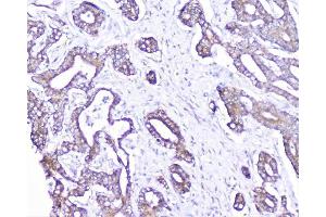 IHC analysis of cortactin using anti-cortactin antibody (ABIN6719306).