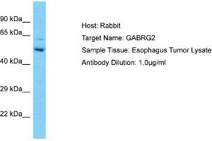 Host: Rabbit Target Name: GABRG2 Sample Type: Esophagus Tumor lysates Antibody Dilution: 1.