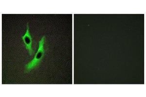 Immunofluorescence (IF) image for anti-STEAP Family Member 4 (STEAP4) (Internal Region) antibody (ABIN1849702) (STEAP4 Antikörper  (Internal Region))