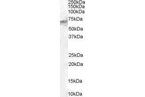 Western Blotting (WB) image for Signal Transducing Adaptor Molecule (SH3 Domain and ITAM Motif) 2 (STAM2) peptide (ABIN369709) (Signal Transducing Adaptor Molecule (SH3 Domain and ITAM Motif) 2 (STAM2) Peptid)