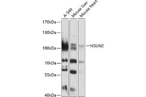 Western blot analysis of extracts of various cell lines, using NSUN2 antibody (ABIN1681117, ABIN3017797, ABIN3017798 and ABIN6220260) at 1:1000 dilution. (NSUN2 Antikörper  (AA 508-767))