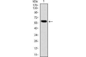 Western blot analysis using BLNK mAb against human BLNK (AA: 34-216) recombinant protein.