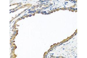 Immunohistochemistry of paraffin-embedded Human prostate using NYX Polyclonal Antibody at dilution of 1:100 (40x lens). (Nyctalopin Antikörper)