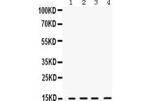 Western blot analysis of ROC1 using anti-ROC1 antibody (ABIN3043566).