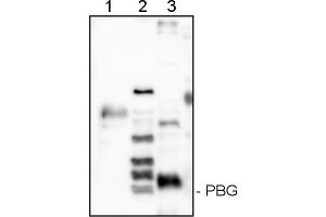 Image no. 1 for anti-Porphobilinogen-Deaminase (PBG) (HemC ) antibody (ABIN334586) (Porphobilinogen-Deaminase (PBG) (HemC ) Antikörper)