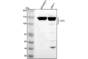 Western blot analysis of CD21/CR2 using anti-CD21/CR2 antibody (ABIN7602433).
