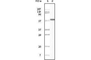 Western Blot showing CK1 antibody used against truncated CK1 recombinant protein. (CSNK1A1 Antikörper)