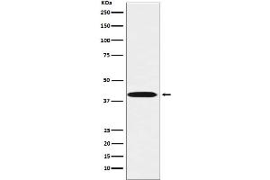 Western blot analysis of LHX3 expression in Jurkat cell lysate.