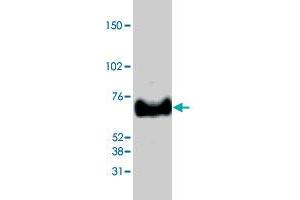 Western blot analysis from 40 ug HeLa nuclear extracts using MECP2 polyclonal antibody  at 1:1000 dilution. (MECP2 Antikörper  (C-Term))