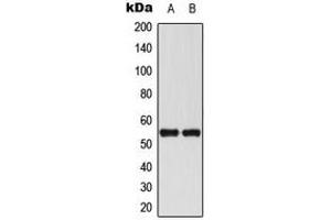Western blot analysis of RUNX1 expression in THP1 (A), Jurkat (B) whole cell lysates. (RUNX1 Antikörper  (Center))