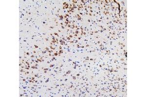 IHC analysis of RET using anti-RET antibody (ABIN6719502).