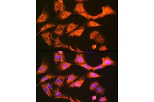 Immunofluorescence analysis of NIH-3T3 cells using GSTK1 Rabbit mAb (ABIN7267442) at dilution of 1:100 (40x lens).