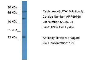 WB Suggested Anti-GUCA1B  Antibody Titration: 0.