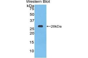 Detection of Recombinant PTCH1, Mouse using Polyclonal Antibody to Patched Homolog 1 (PTCH1) (Patched 1 Antikörper  (AA 213-422))