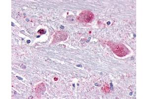 Anti-NR1D1 antibody IHC of human brain, neurons and glia. (NR1D1 Antikörper  (Internal Region))