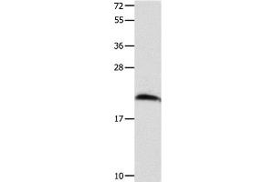 Western Blot analysis of Mouse brain tissue using FGF12 Polyclonal Antibody at dilution of 1:700 (FGF12 Antikörper)