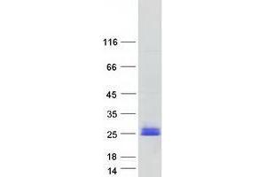 Western Blotting (WB) image for Transmembrane Protein 17 (TMEM17) protein (Myc-DYKDDDDK Tag) (ABIN2733857)