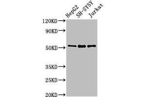 Western Blot Positive WB detected in: HepG2 whole cell lysate, SH-SY5Y whole cell lysate, Jurkat whole cell lysate All lanes: PRKN antibody at 3 μg/mL Secondary Goat polyclonal to rabbit IgG at 1/50000 dilution Predicted band size: 52, 49, 24, 31, 43, 36, 44, 47 kDa Observed band size: 52 kDa (Parkin Antikörper  (AA 1-465))